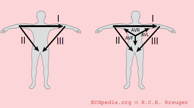 Diagram af hjerteaksen