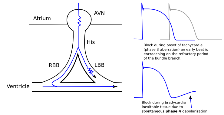 Phase 3 og 4 aberration